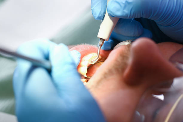Best Emergency Root Canal Therapy in South Lyon, MI
