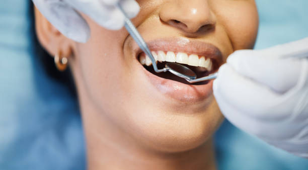Best Dental Abscess Treatment in South Lyon, MI
